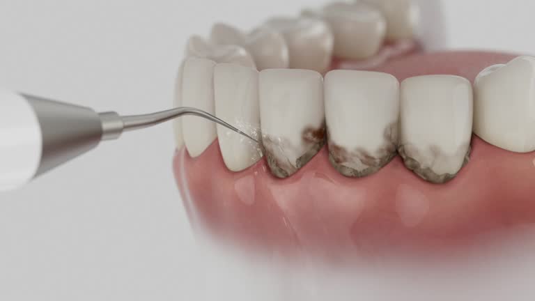 Reliable Root Canal Treatment contractor in Montgomery County County, NC by Dentist Open Now